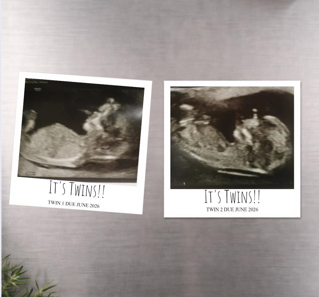 Personalised Pregnancy Scan Announcement Keepsake Gift